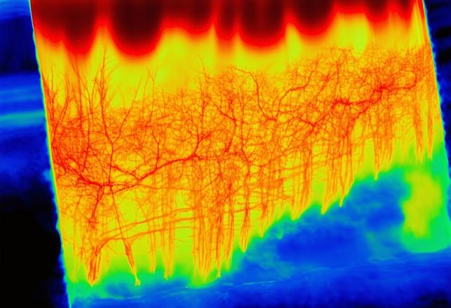 Image infrarouge montrant la signature thermique d'une brûlure au deuxième degré pour une visualisation scientifique en haute définition.