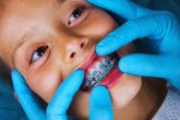 Enfant avec un appareil d'orthodontiste