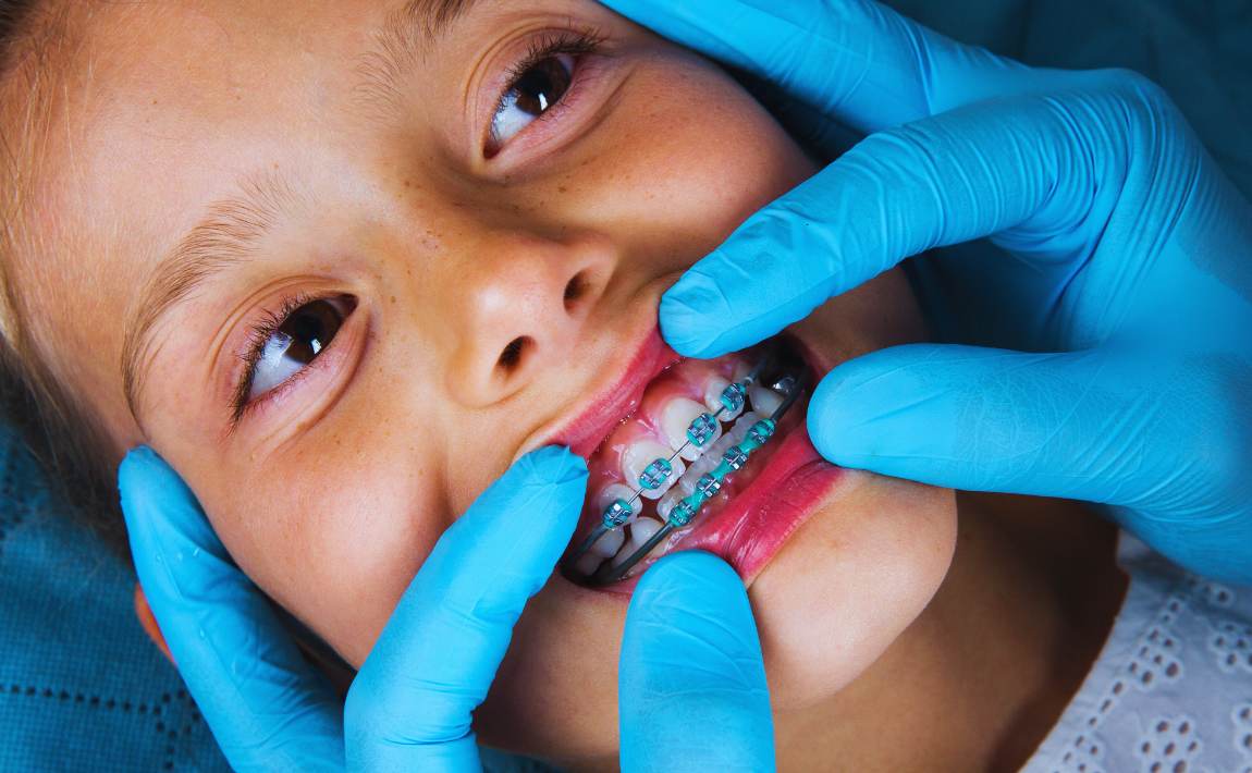 Enfant avec un appareil d'orthodontiste