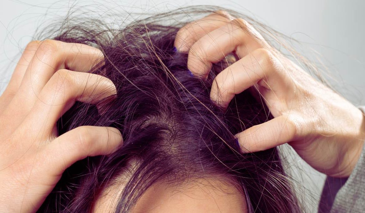 Les cheveux d'une femme qui démange